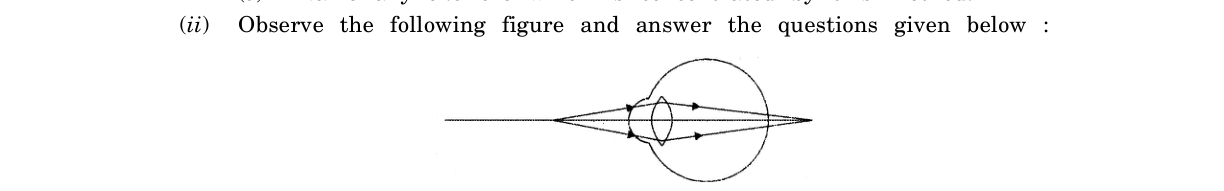 diagram for Identify eye defect from figure: cause and correction