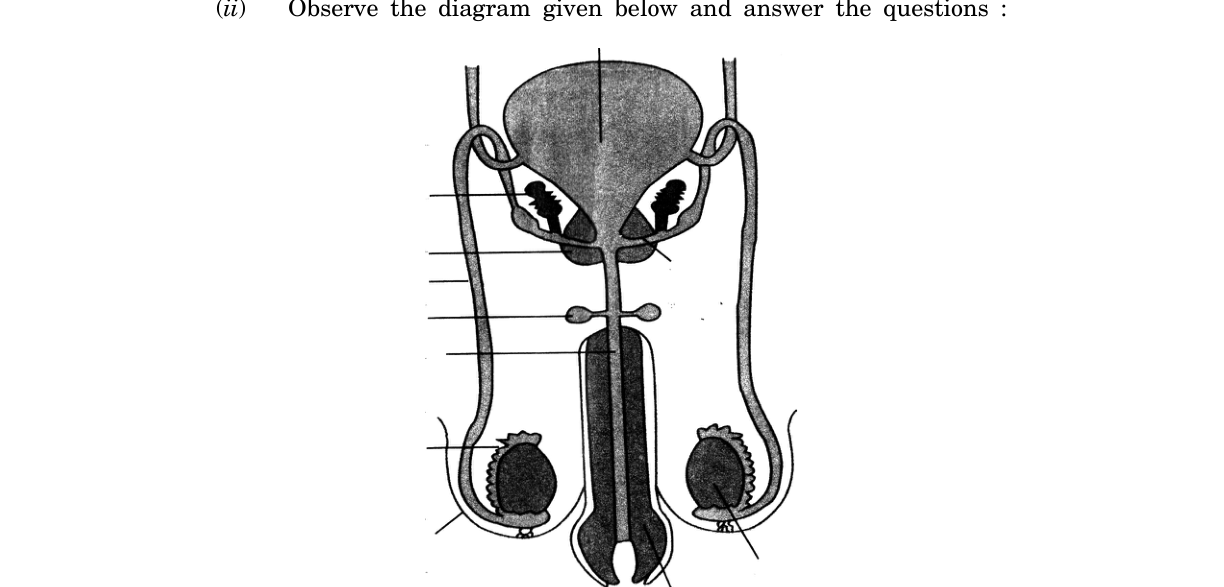 diagram for Male reproductive system: sub-questions