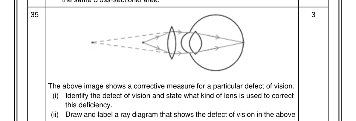 diagram for Identify a vision defect and show its correction