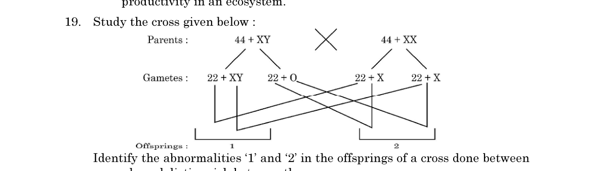 diagram for Chromosomal aneuploidy disorders